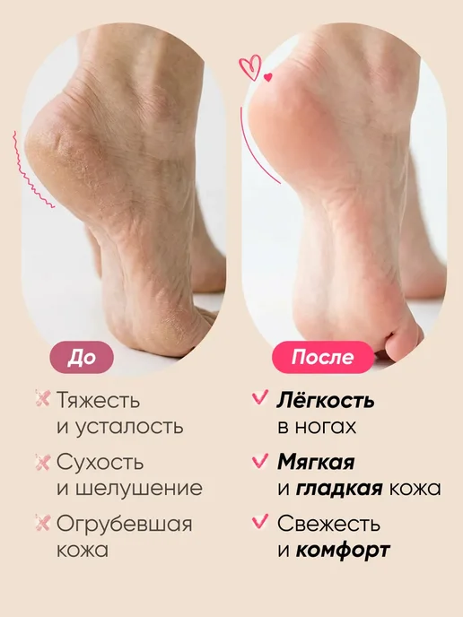 Кератолитик для пяток набор для педикюра SPA желе, вариант, фото 6