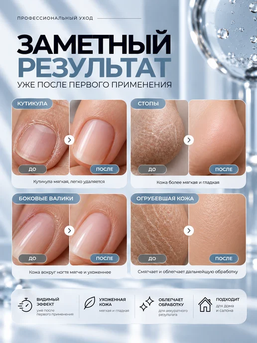 Smart Master Мульти Бустер Смарт мастер для стоп и ногтей 15 мл, 15 мл, фото 5