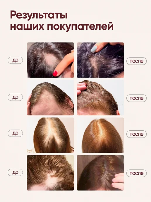 Масло имбиря активатор роста волос и средство от выпадения, вариант, фото 3